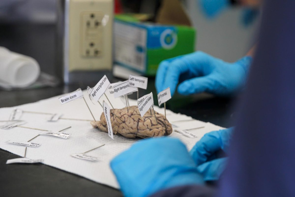 Larry Sheller's Human Body Systems Class Dissects a Sheep Brain [Photo Gallery]