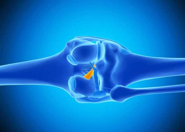 ACL tears: How do they impact athletes?